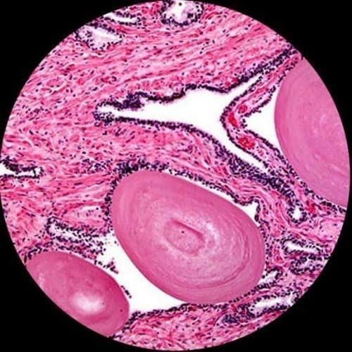 AmScope M150C-PS25 Series Portable Monocular Compound Microscope - 1000X | 40X-1000X Magnification Range Compound Biological Microscope LED Ring Light